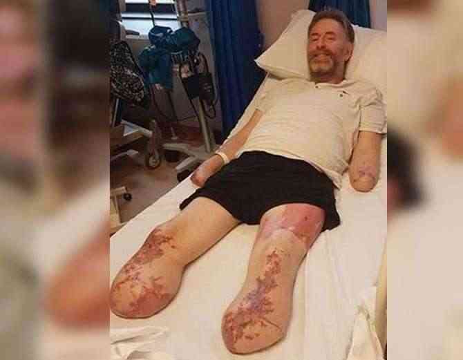 Doctors Cut man Legs Arms