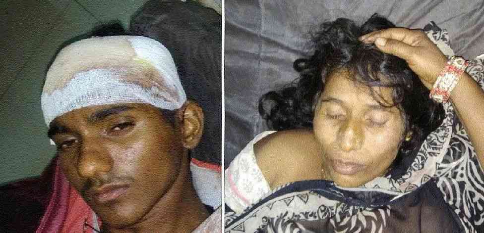 injured wife and son in singrauli incident