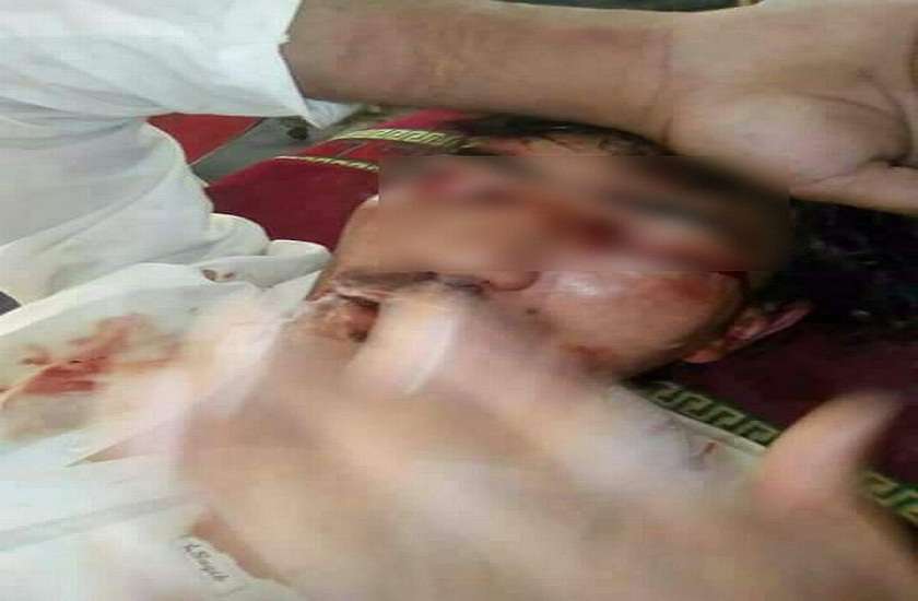 22 year old boy brutally attacked by his dad and four brothers