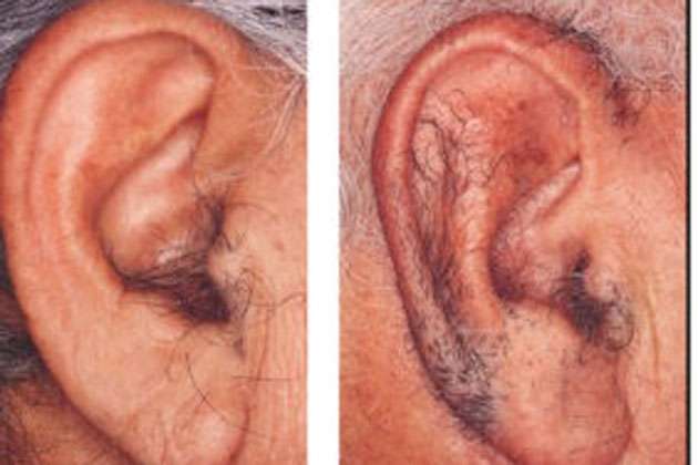 p18_ear4.jpg