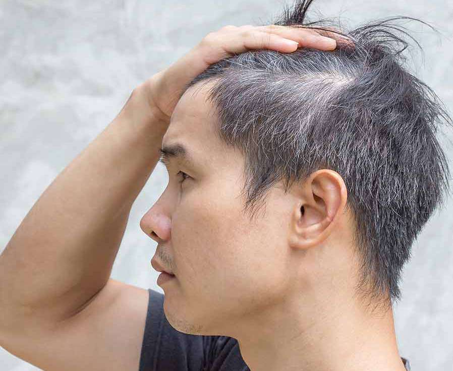 वे 12 लक्षण जो ग्रे बाल होने का इशारा करते हैं