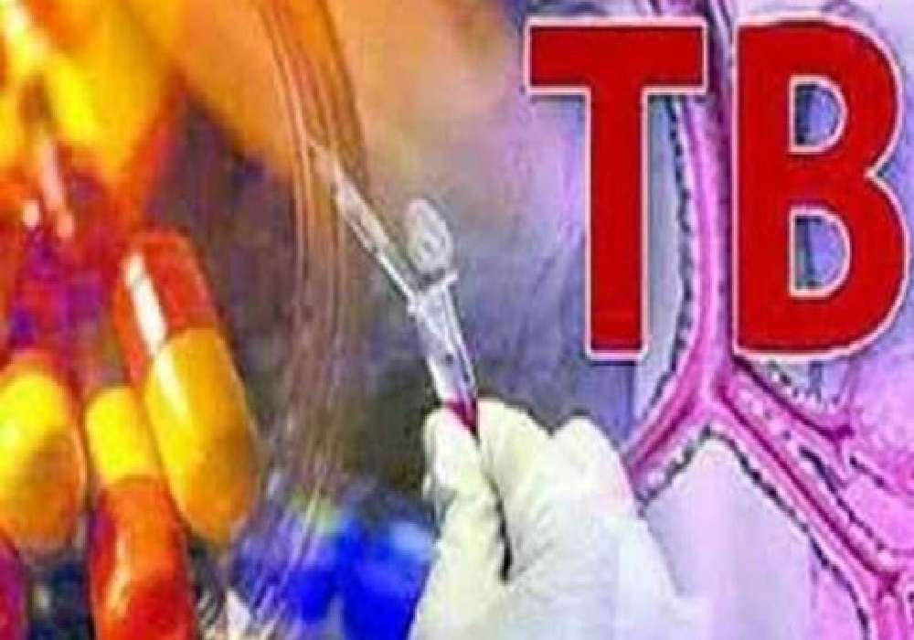 दस दिवसीय अभियान में खोजे गए 73 टीबी रोगी, लक्ष्य पार कर 3.54 लाख की स्क्रीनिग