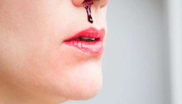 nose-bleeding.jpg
