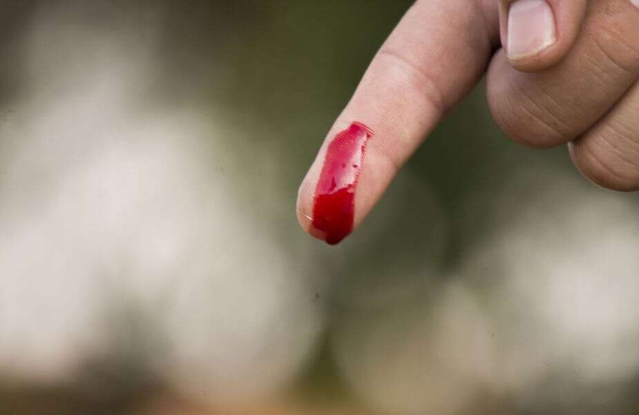bleeding.jpg