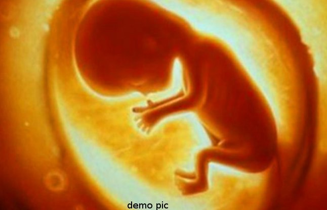 foetus Found in the River Narmada 