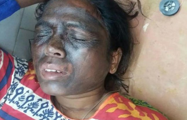 AAP leader Soni Sori attacked