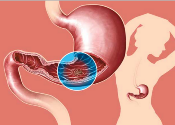 side effect of cold drink