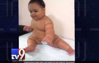 Laptin hormone patient second child in India