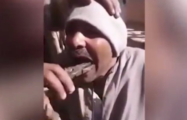 man pulled out teeth with pliers