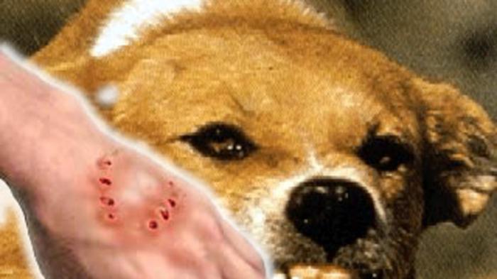 rabies infection killed a 11 year old girl