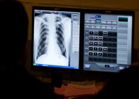 chest x-ray
