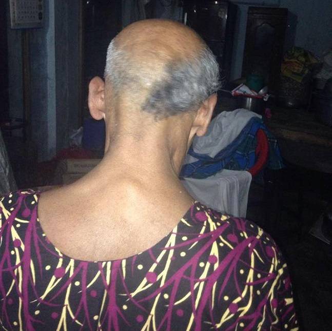 Kerala fast food vendor, 70, shaves off half head
