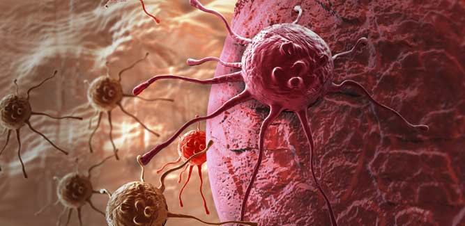 new method can kill cancer in few hours
