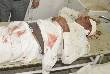 Accident on sikar-churu road near ramgarh