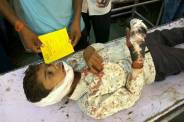 student injured in road accident