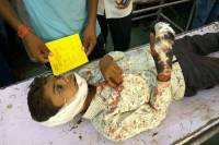 student injured in road accident