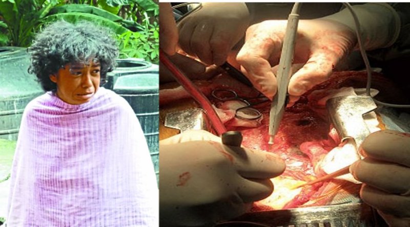 Organ Harvesting and Human Trafficking, Market, Yogi Adityanath, Gorakhpur,BRD college,Uttar Pradesh