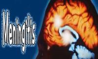 meningitis