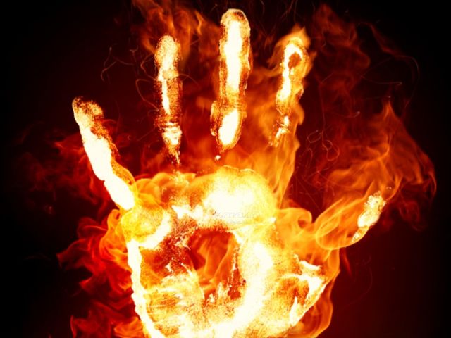 dowry case, woman put in to fire