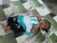 Every fifth child in this district is malnourished