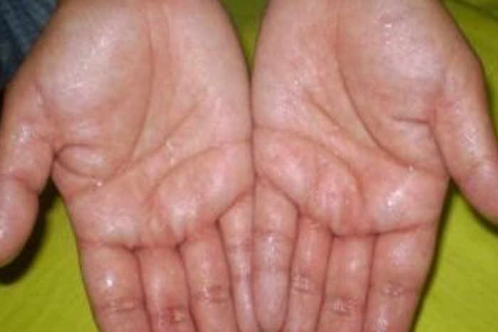 Bhilwara, bhilwara news, Misdeeds from a woman in bhilwara, Latest news in bhilwara, bhilwara news in hindi, Latest bhilwara news in hindi