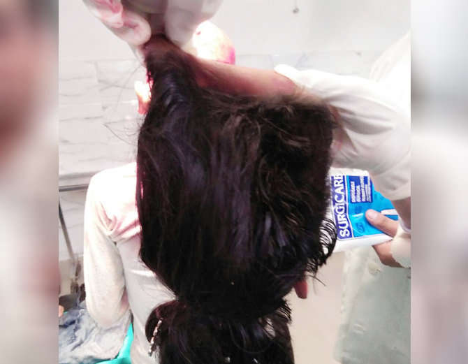 girl skull removes, hair trapped, hair trapped in generator saftin