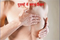 health issues of men