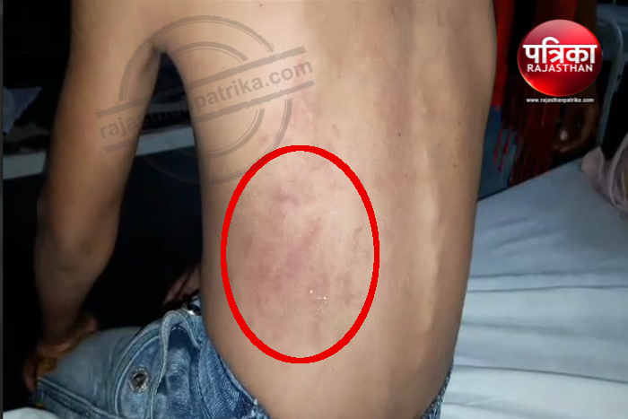 Bhilwara, Bhilwara news, Ruthlessly beaten up in the school in bhilwara, Latest news in bhilwara, Bhilwara news in hindi, Latest hindi news in bhilwara