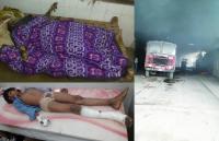 Lady Burned Child Burn by Battery Blast and Fire in Factory