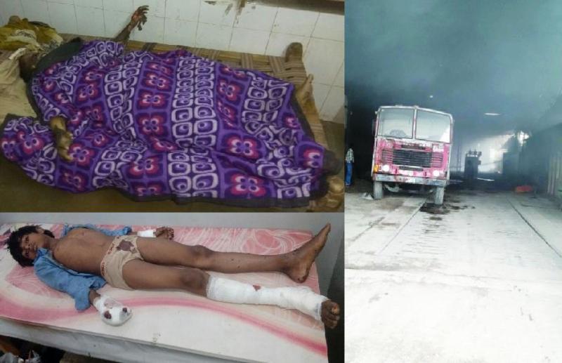 Lady Burned Child Burn by Battery Blast and Fire in Factory