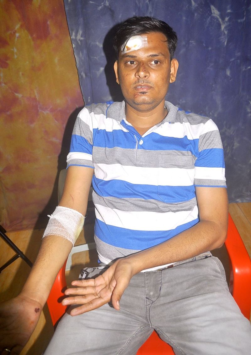 MP : Mobile blast first incident in Burhanpur in the hands of youth