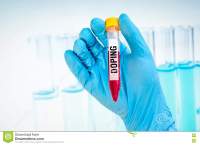 doping test 