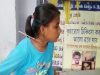 Arrow pierces neck of archer survived by a millimetre