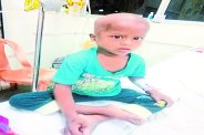 suffering child 