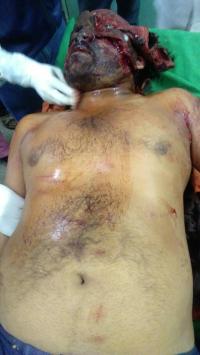 Bear attack on Indian railway station employees railway news