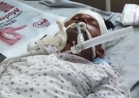 A man fall down from Train is Serious