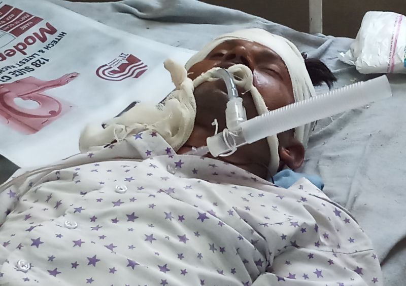 A man fall down from Train is Serious