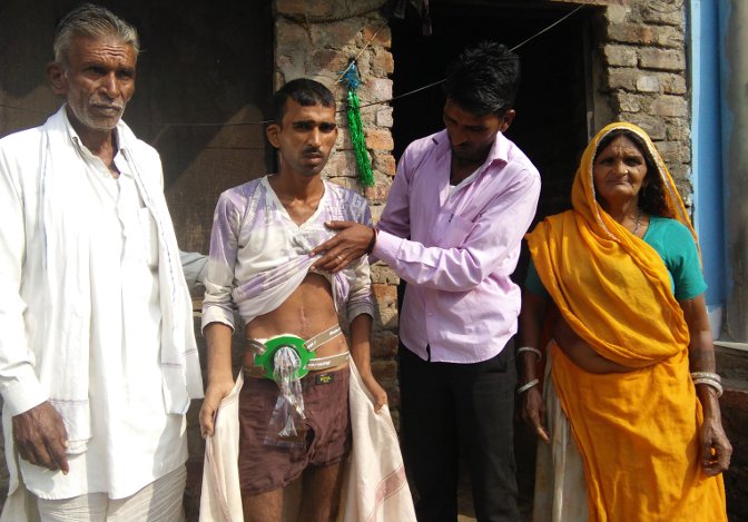 Appendix, Half-incomplete treatment, Mis-operation, Young man in Danger, Medical Department, Neglected medicine, Treatment, Dr. Navneet Parashar, Health department, Charges of negligence, Kota, Kota Patrika, Kota Patrika News, Rajasthan Patrika