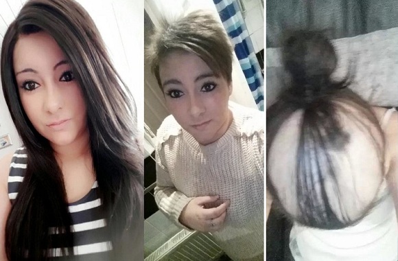 Breakup, girl became bald, बाल झड़गा, ब्रेकअप