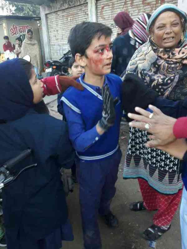 school auto and bus accident images udaipur