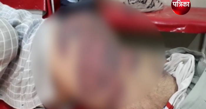 third degree torture