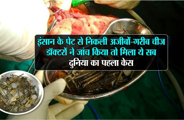 Heavy iron made things found in patient stomach