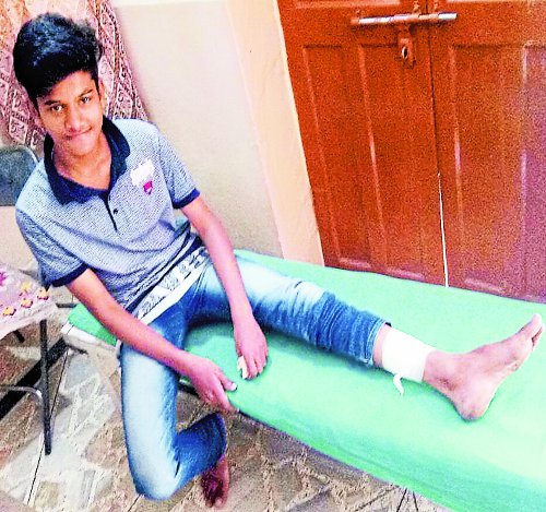 Pigs attacked on the child