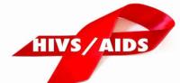 hiv aids