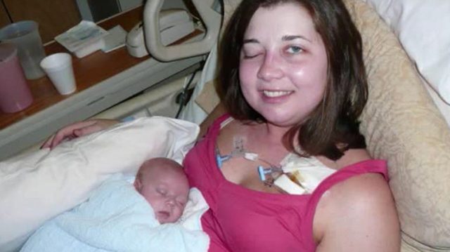Pregnant mom with stage 4 cancer delivers baby