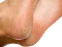 Gharelu nuskhe for health 