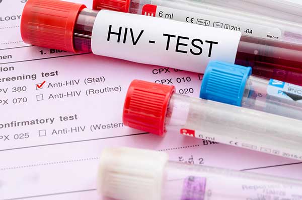 Wrongly HIV positive Declared