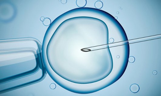 Time lapse Technology in IVF