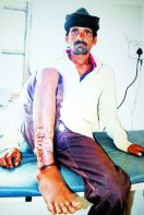 bear attacks on farmer in falasiya