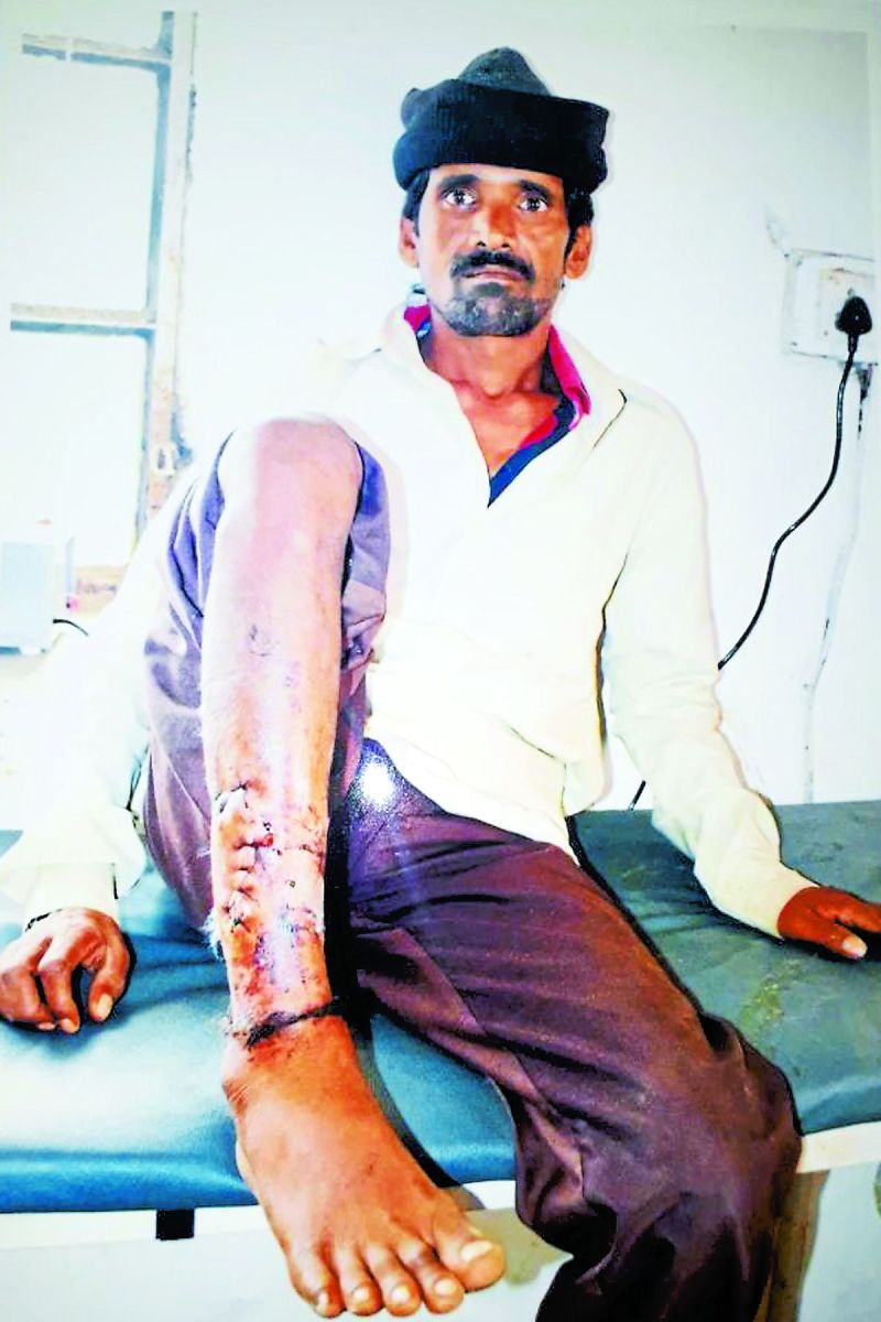 bear attacks on farmer in falasiya